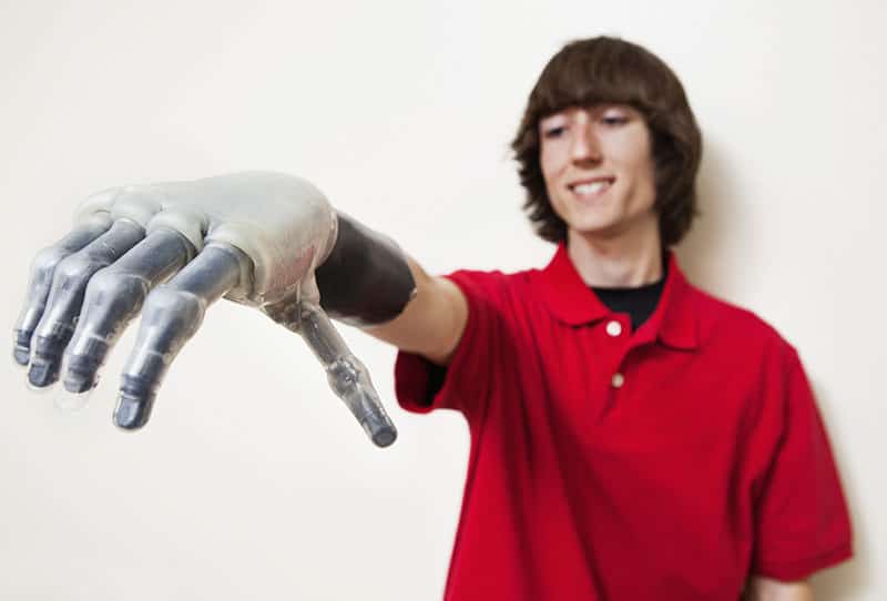 Prosthetic Limb Damage