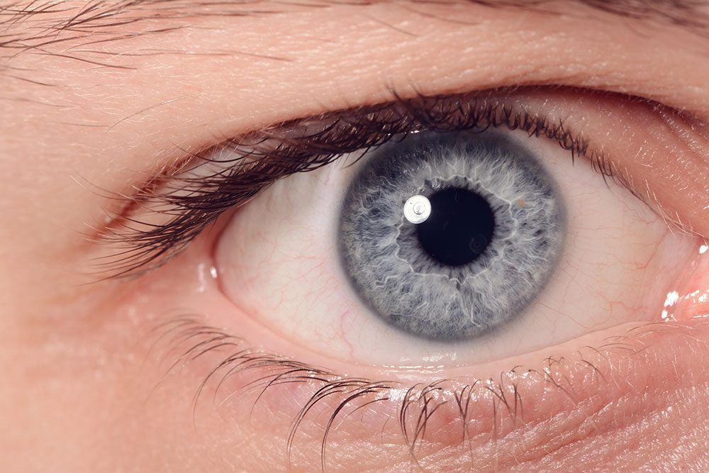 Elmiron Eye Attorney