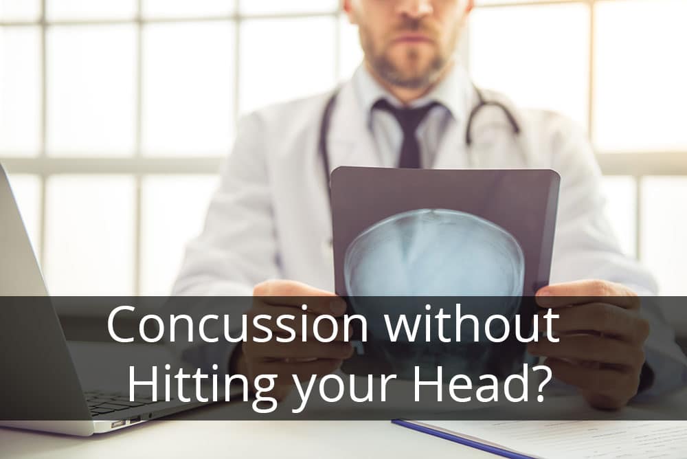 Concussion Without Hitting Your Head?